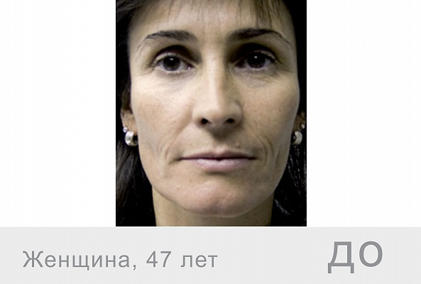 F-XFC+ Полиревитализирующий комплекс (63 компонента), 5мл фото 3