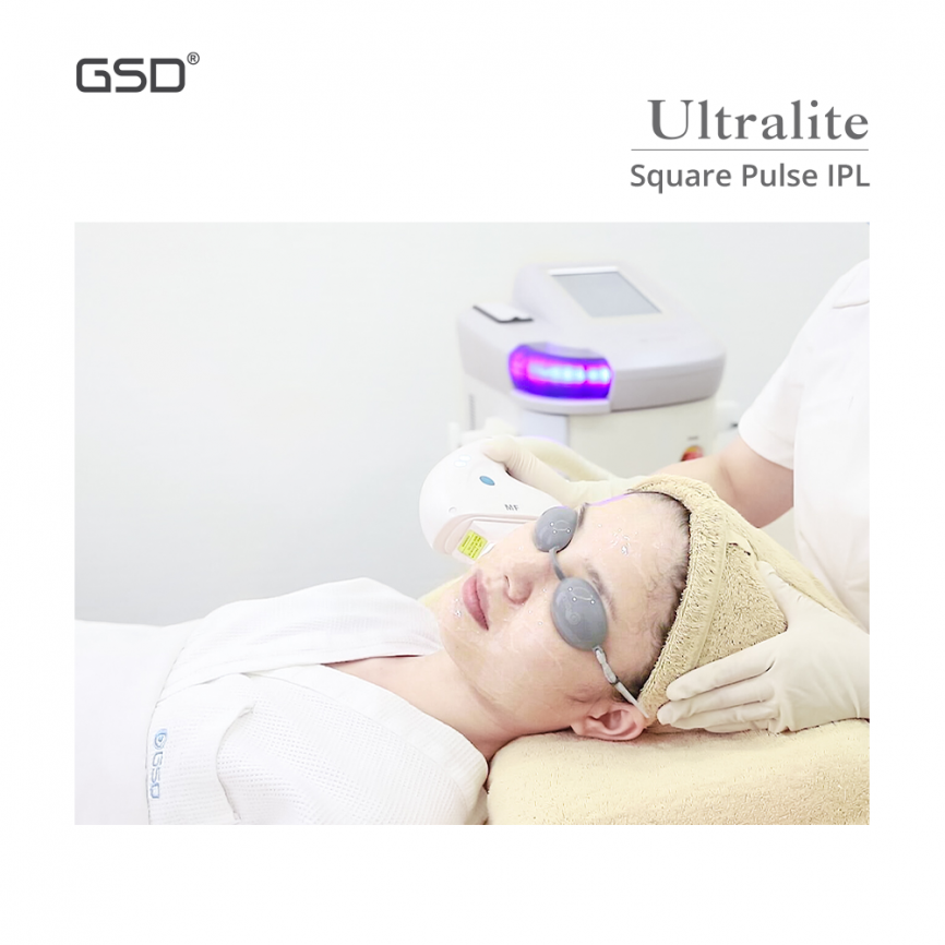 Aппарат IPL-терапии Ultralight фото 8